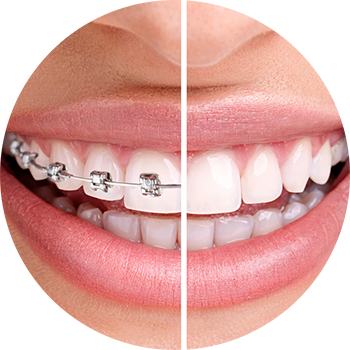 ortodoncja